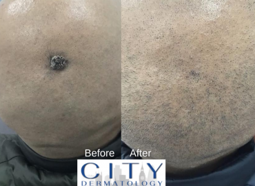 City Dermatology Clinic