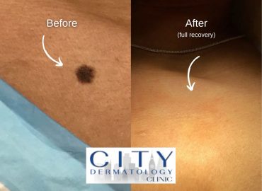 City Dermatology Clinic